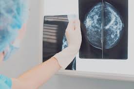 Diagnostics imaging Mamnogram